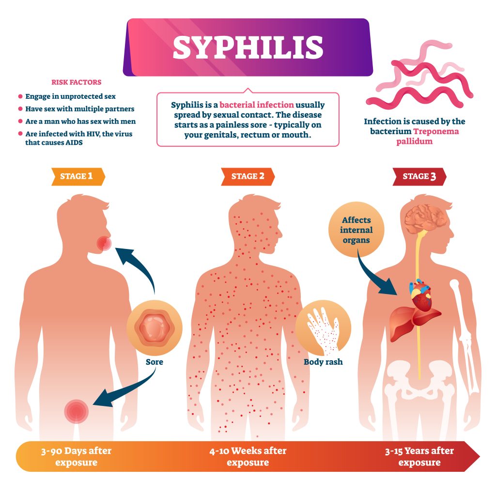 Coos County Is Experiencing A Rapid Rise Of Syphilis Coos Health